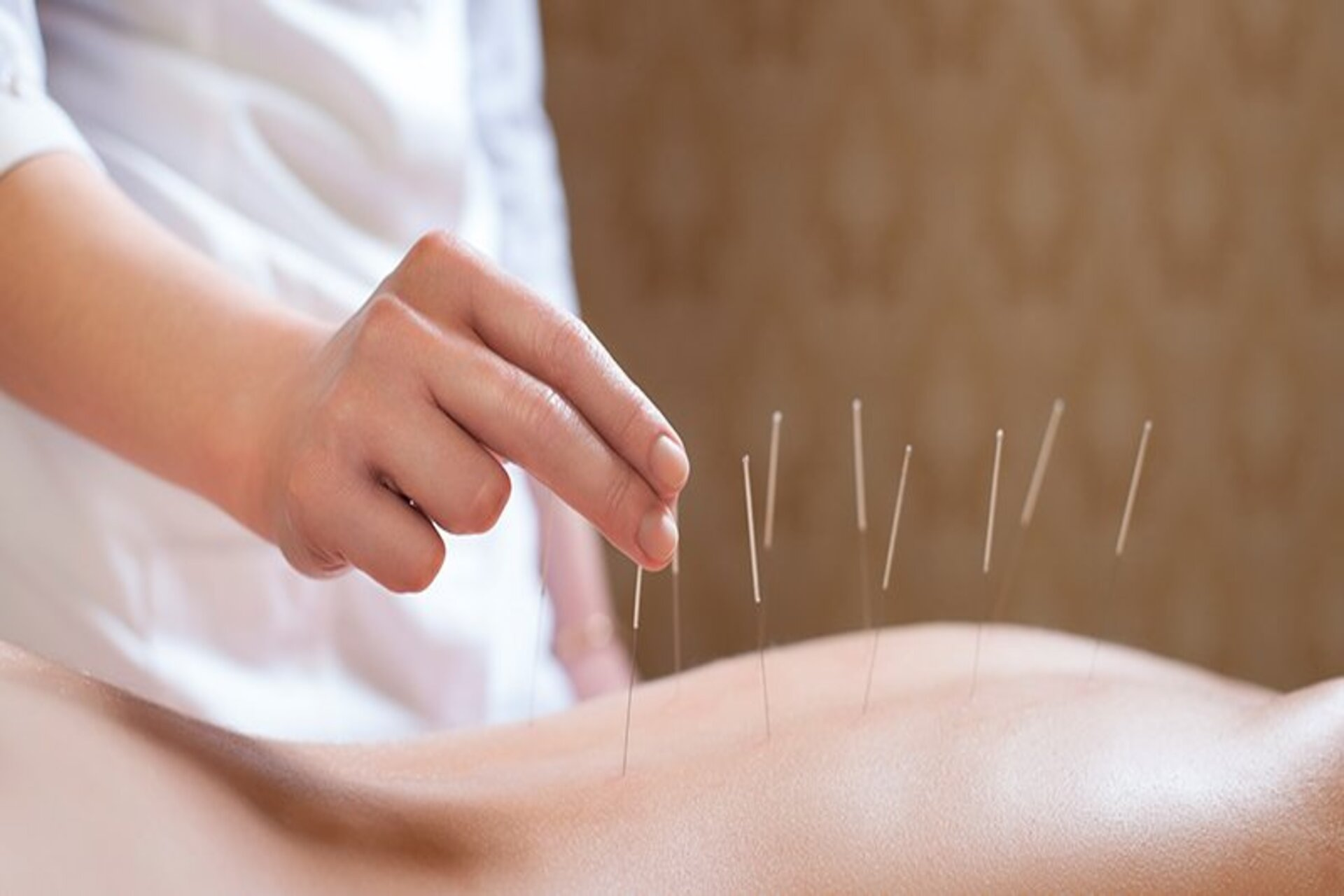 A acupuntura é um sistema (um processo) de atenção à saúde que é baseado (que se baseia) na teoria da medicina oriental e práticas correlatas. O diagnóstico e tratamento com base nestas teorias e (suas) práticas são utilizados para promover a saúde e tratar distúrbios orgânicos e/ou funcionais.